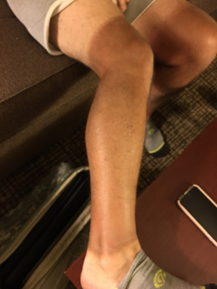 leg